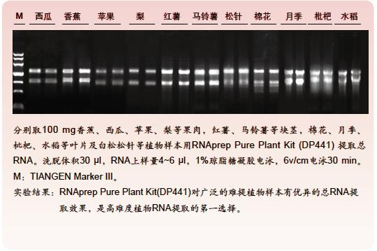 天根RNAprepPure多糖多酚植物总RNAti取试剂